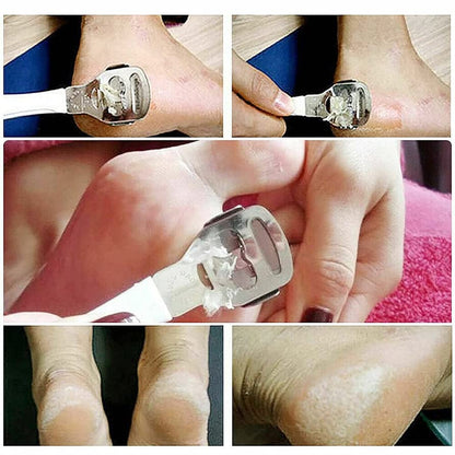 All-In-One Stainless Steel Nail and Foot Care Set: Nail Clipper, Nail Tip Cutter, Nail Pusher, Spoon Nail Cleaner, Nail Cleaner Brush, Nail Buffer, Nail Polish Separator, Foot Filer, Callus Remover, Pumice Stone, Nail File